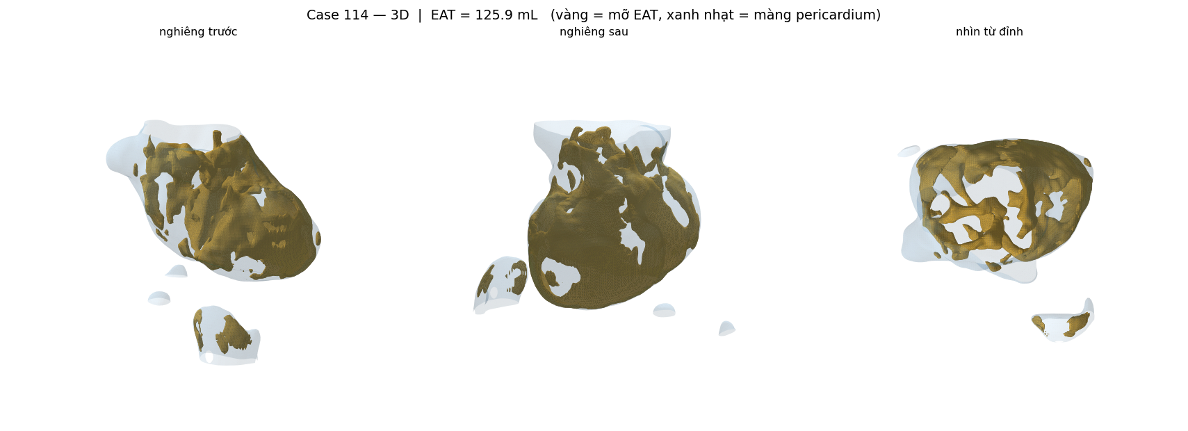 case 114 3D