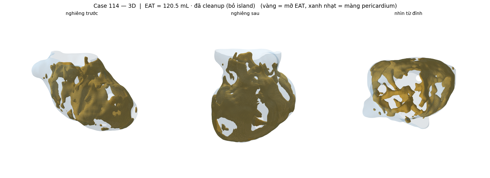ca 114