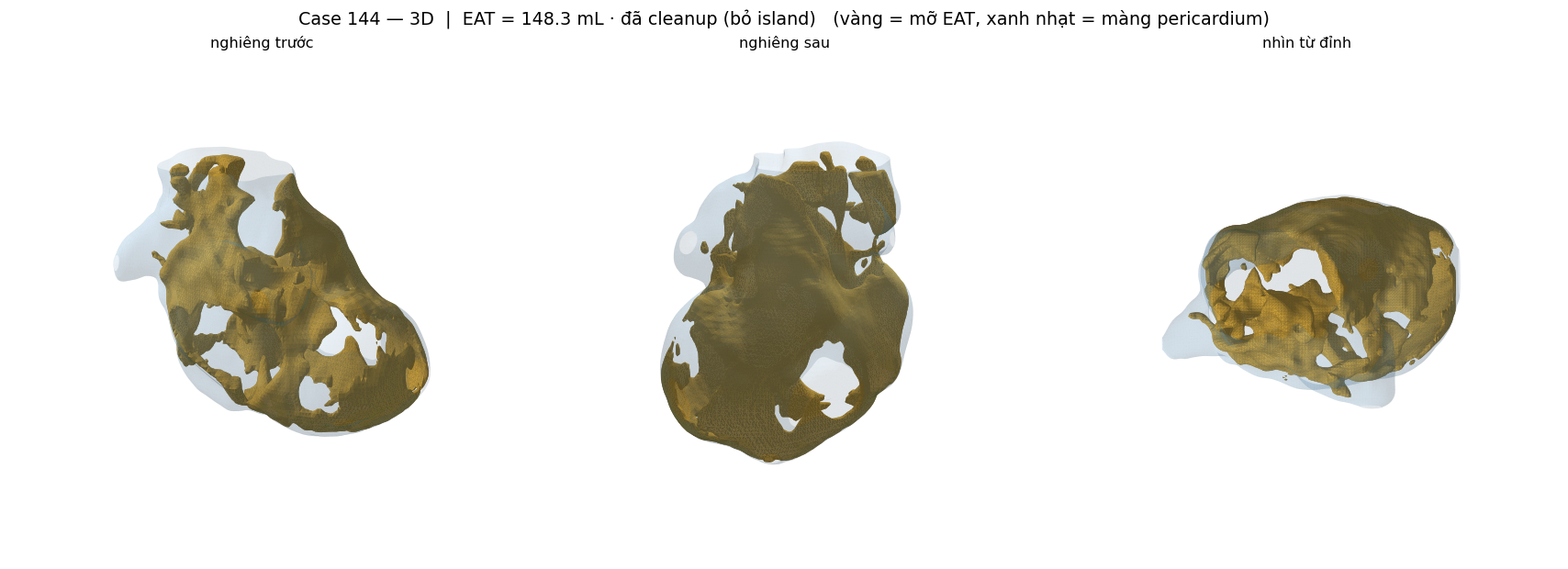 ca 144