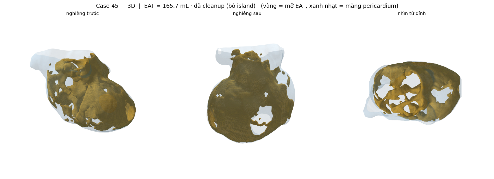 ca 45