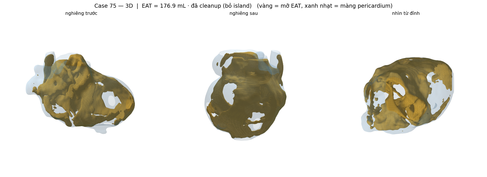ca 75