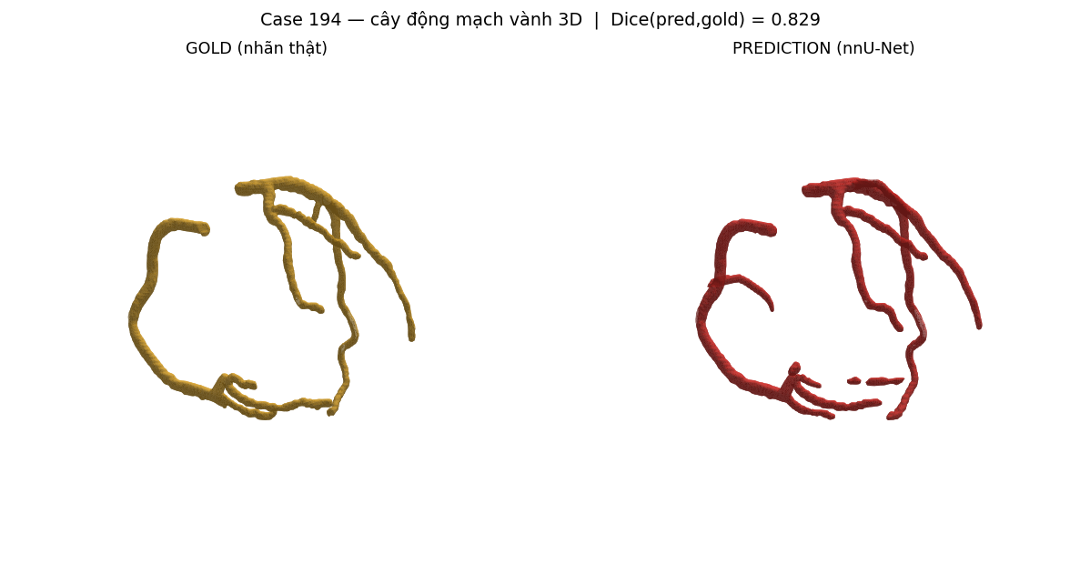 ca 194 coronary 3D