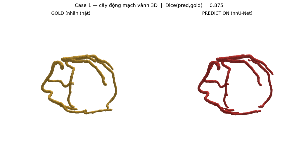 ca 1 coronary 3D