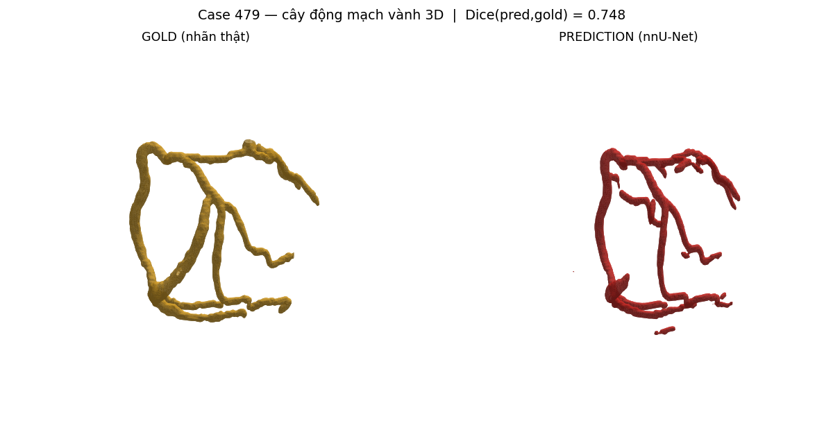 ca 479 coronary 3D