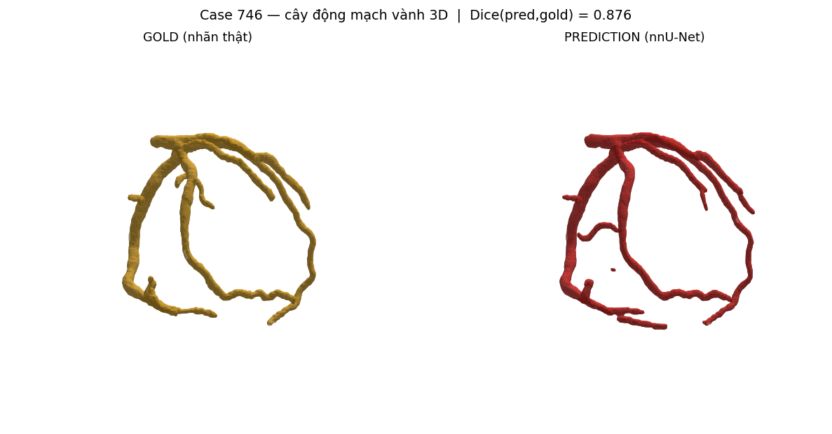 ca 746 coronary 3D
