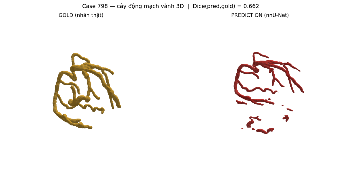 ca 798 coronary 3D
