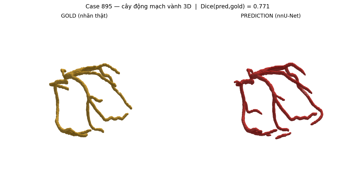 ca 895 coronary 3D