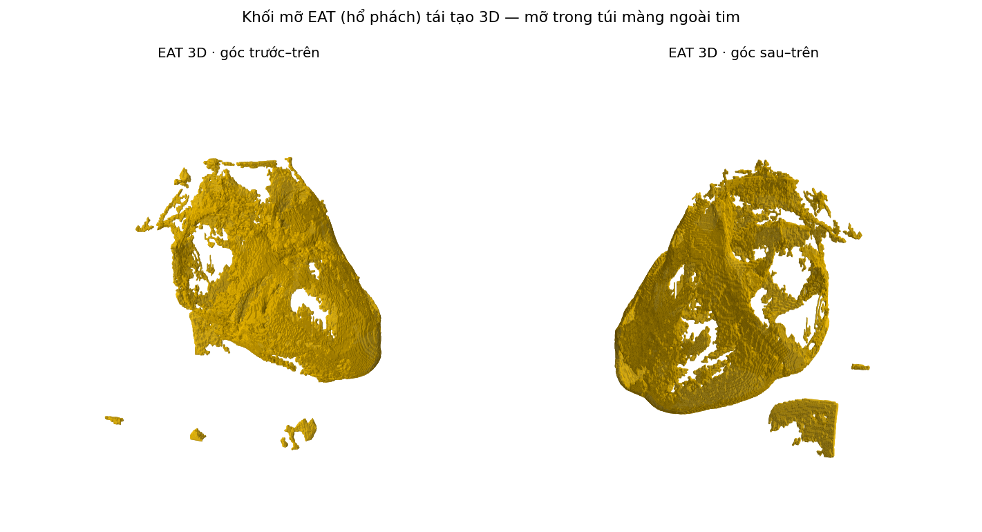 Tái tạo 3D khối mỡ EAT màu hổ phách ở hai góc nhìn